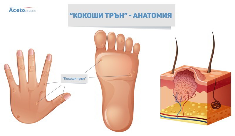 Анатомия на кокошия трън